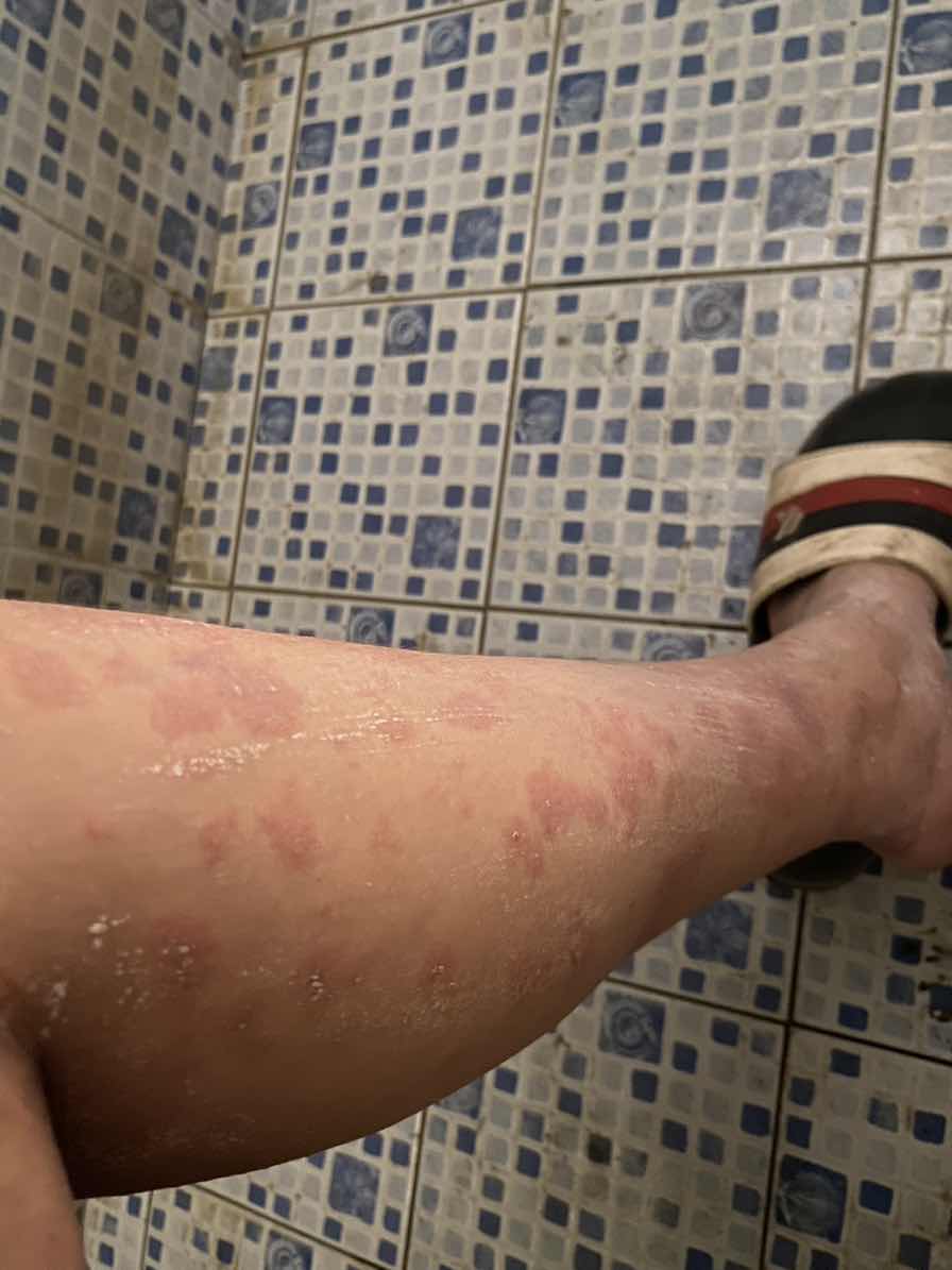 หลังคลอดแม่บ้านไหมเป็นแบบนี้บ้างไหมคะ