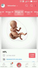 OTW 40week blm ada tanda2 lahiran