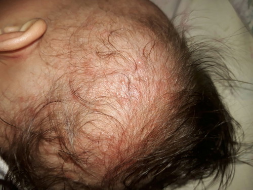 Baby Mb's Head