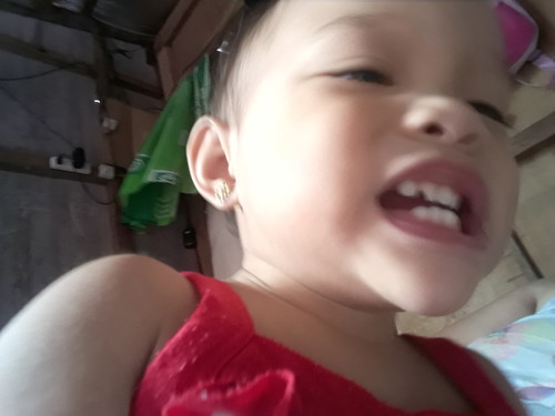My daughter teeth