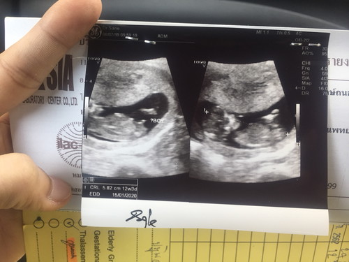 ผช.คับผม