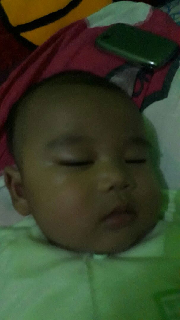 bercak putih di sekitar alis bayi