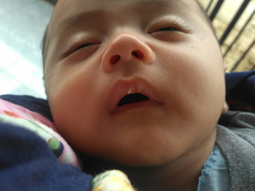 bibir pecah2
