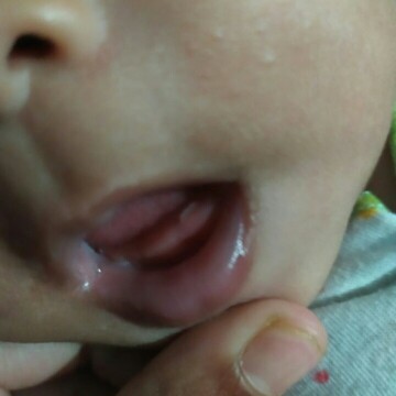 tumbuh gigi usia 3bln