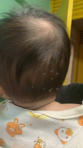 Baby hair grow white thing