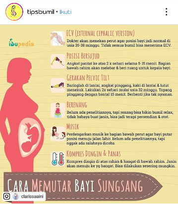 Cara memutar bayi sungsang