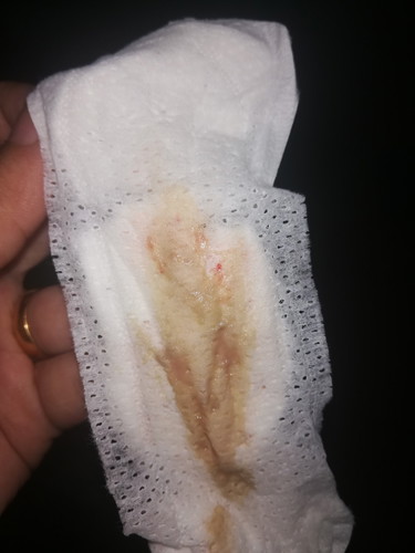 IMPLANTASI ATAU JANGKITAN??