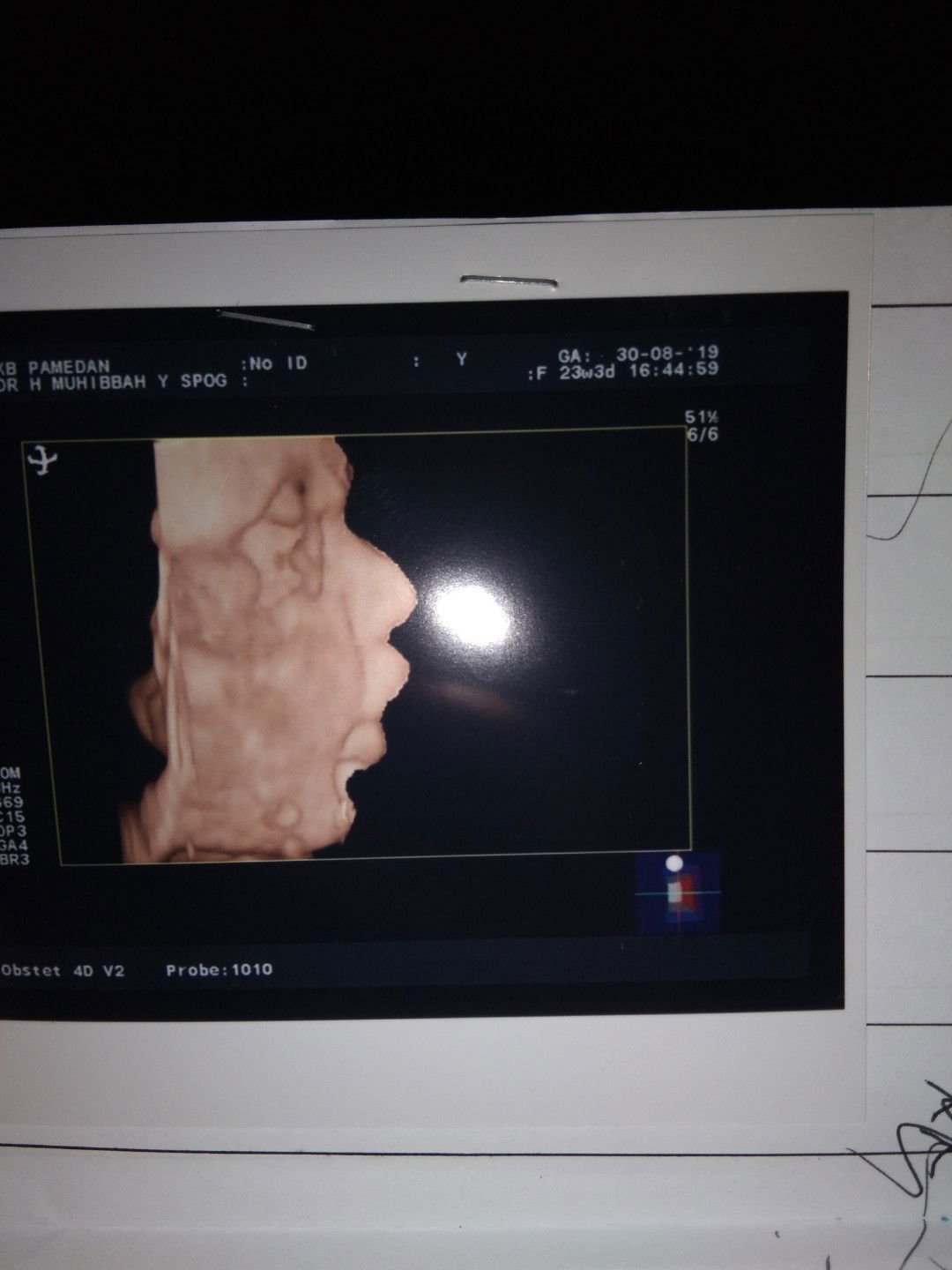 Seneng tapi ngap-ngappan ?