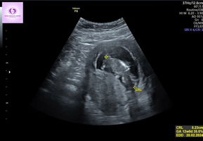 Alvionita Nainggolan profile icon