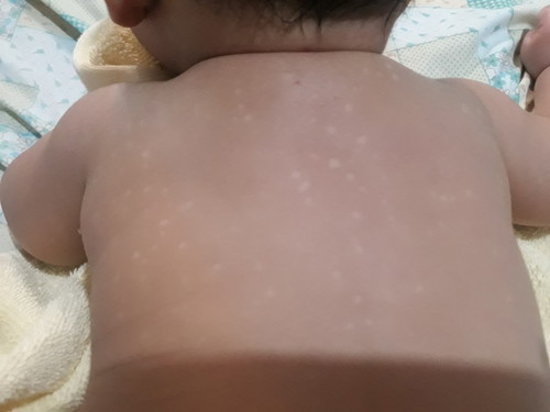 white spots