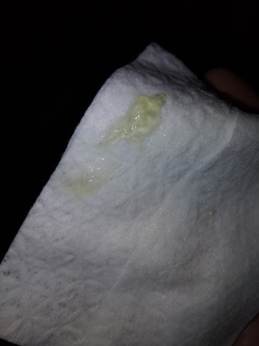 mucus plug?