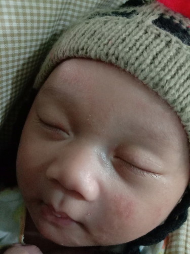kulit bayi