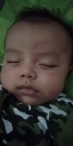 biang keringat