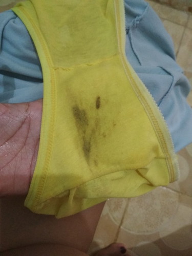 Flek 35 Minggu