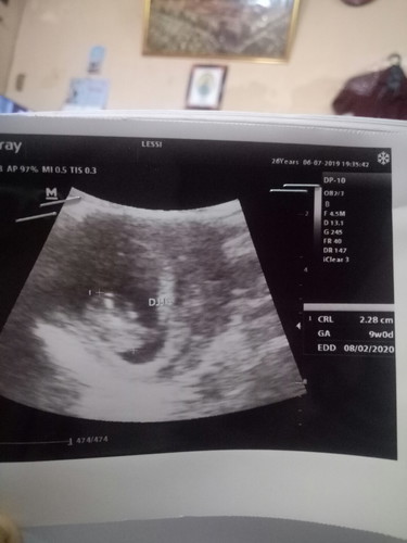 menghitung umur kehamilan