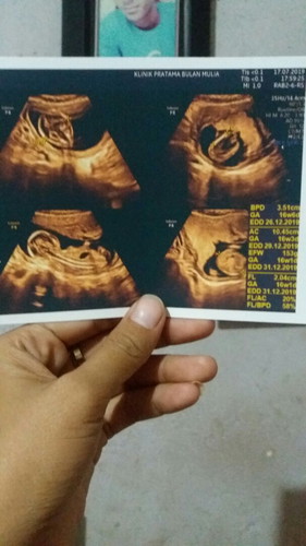 mohon bantuannya bunda...