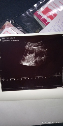 Hamil 10 week