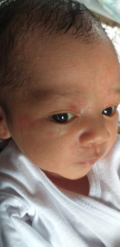 Rashes