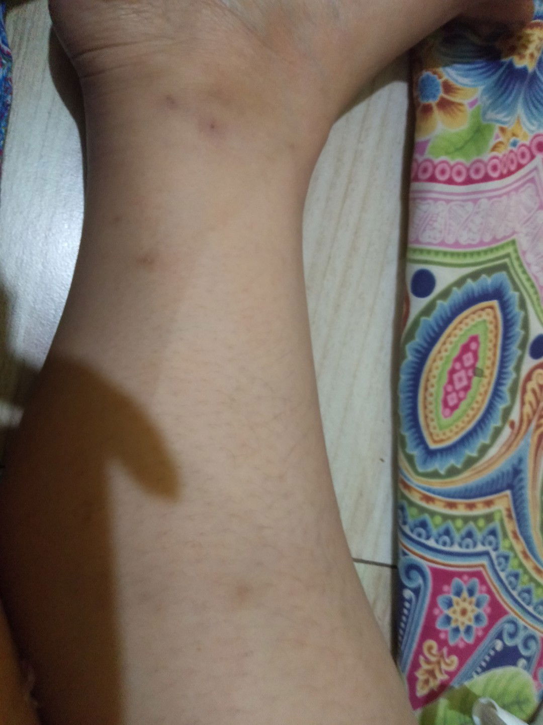 gatal gatal tapi bukan bentol, dan bukan di gigit nyamuk