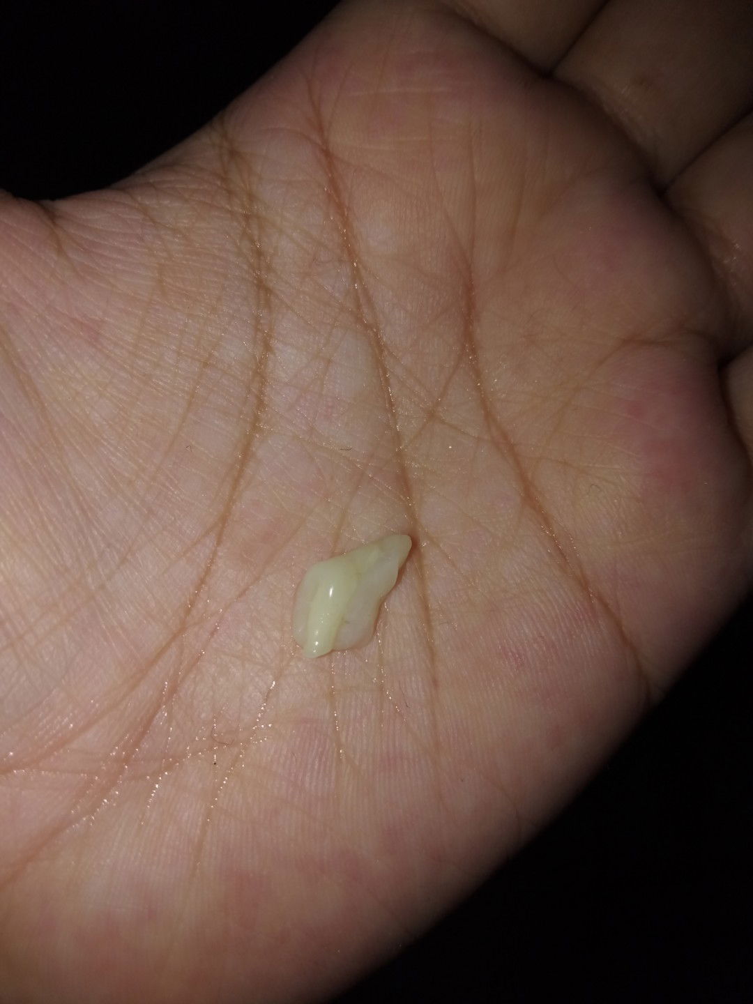 hamil 25week , anak pertama