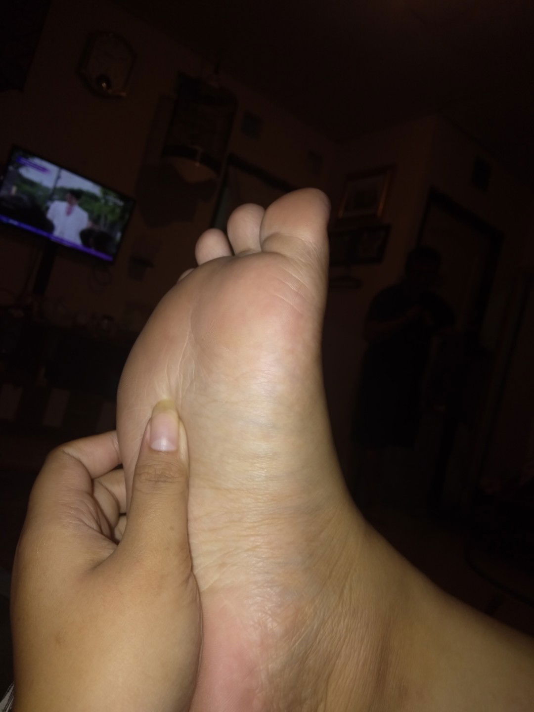 telapak kaki sakit di saat menapakan jalan