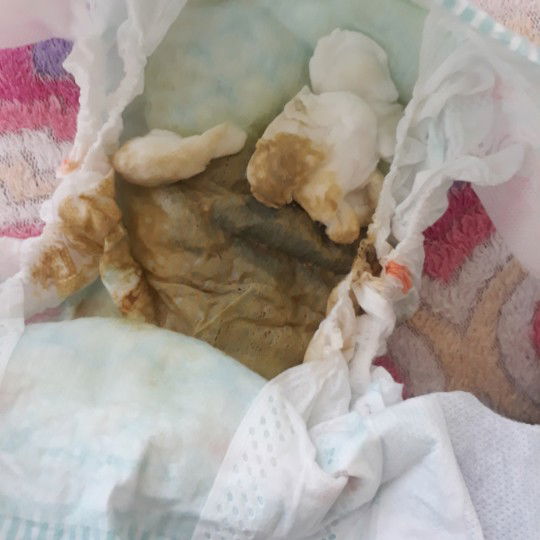 baby poop