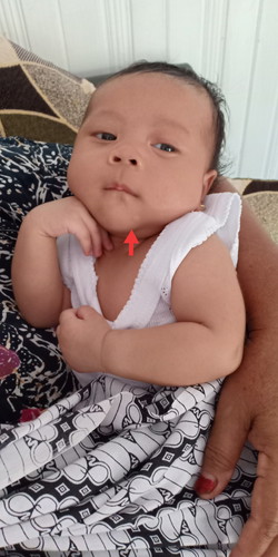 bulat putih
