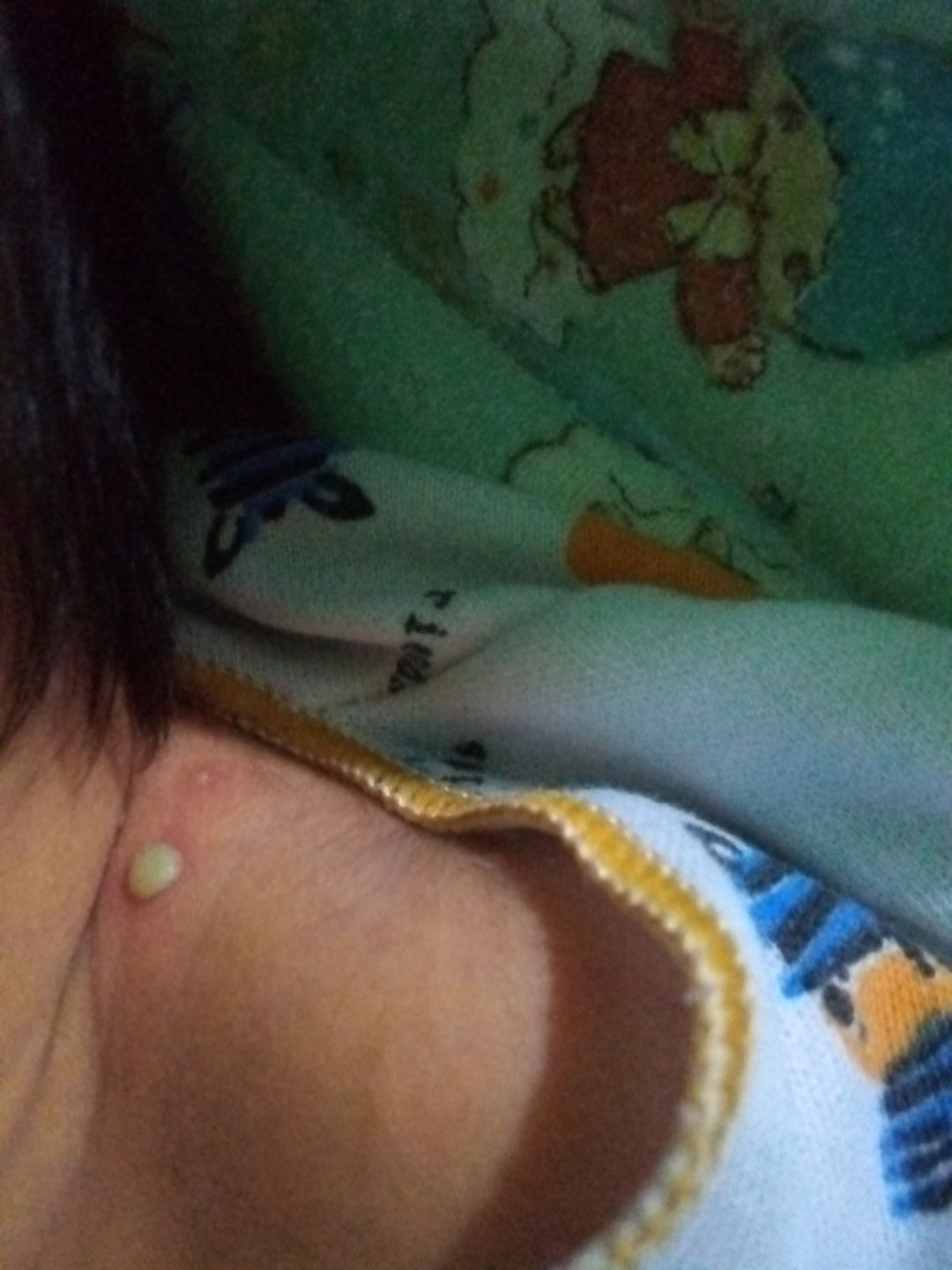 Bayi baru lahir kena sarab