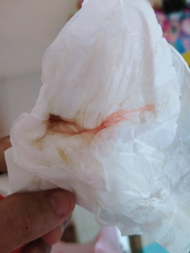 อันตรายมั้ยถามแม่ๆ