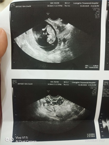 เครียดมาก