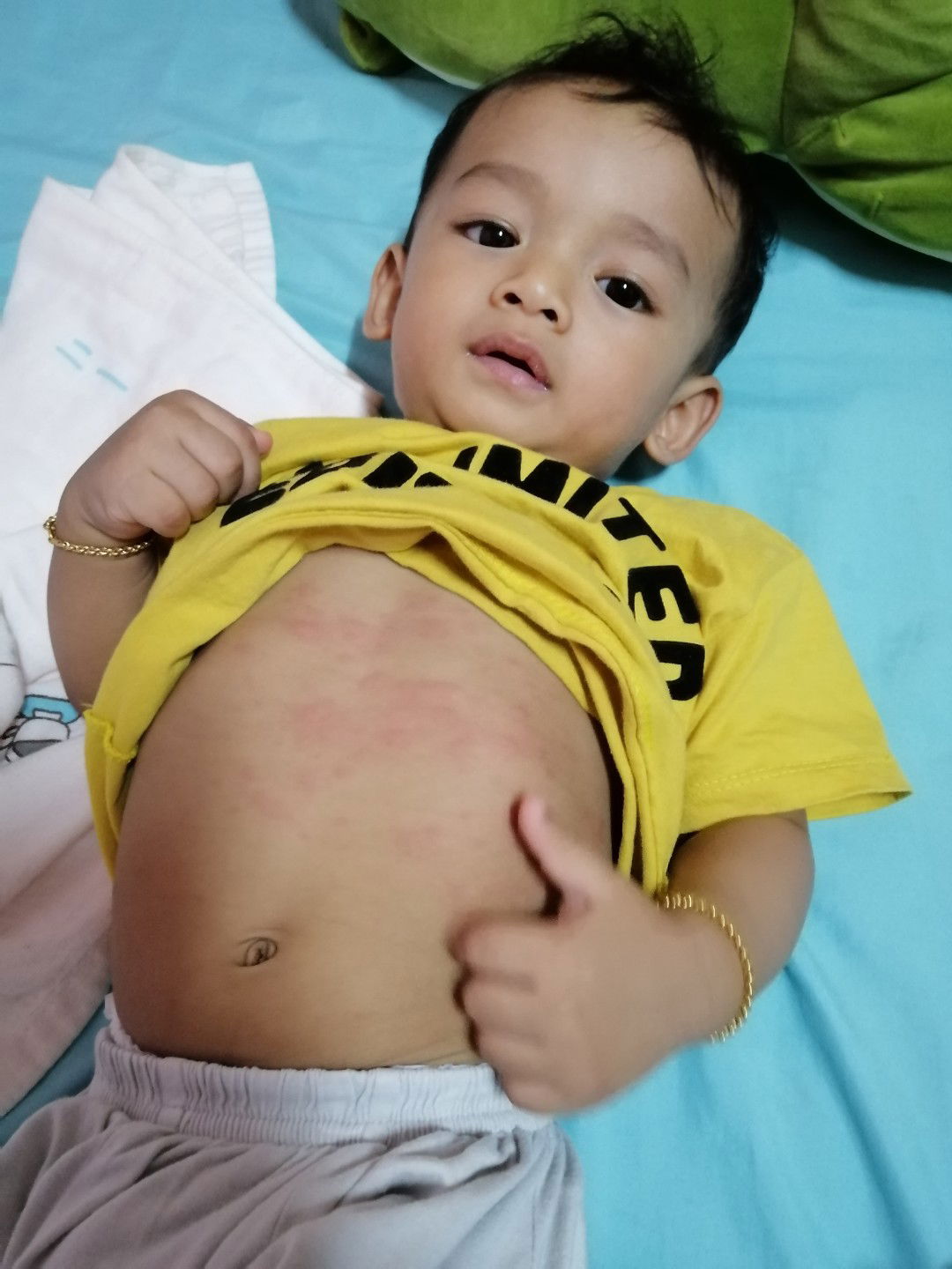 ลูก 11 เดือนกว่า บ้านไหนเป็นแบบนี้บ้างคะ ใช้อะไรถึงหาย