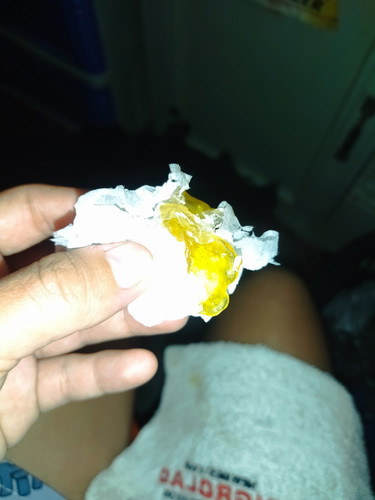 Normal po ba na pag naglagay ka ng evening primose oil sa pwerta may lalabas na ganyan?