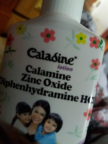 caladine lotion