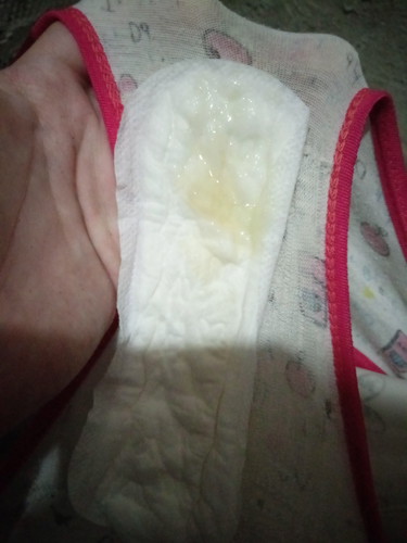 hi po tanong ko lang po kung ano po to