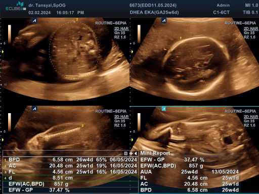 Bun mau nanya dong bun,,bantu jawab yaaa