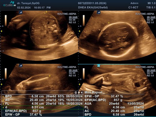 Bun mau nanya dong bun,,bantu jawab yaaa