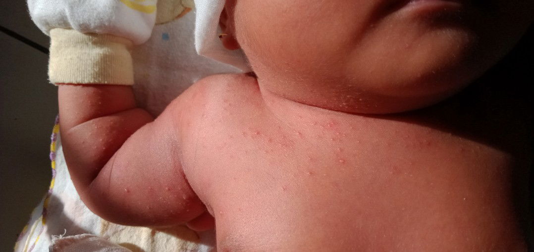 ada yg pernah bayinya kaya gini ga bun???