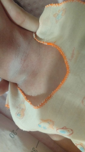 ลูกน้อยคอแดง