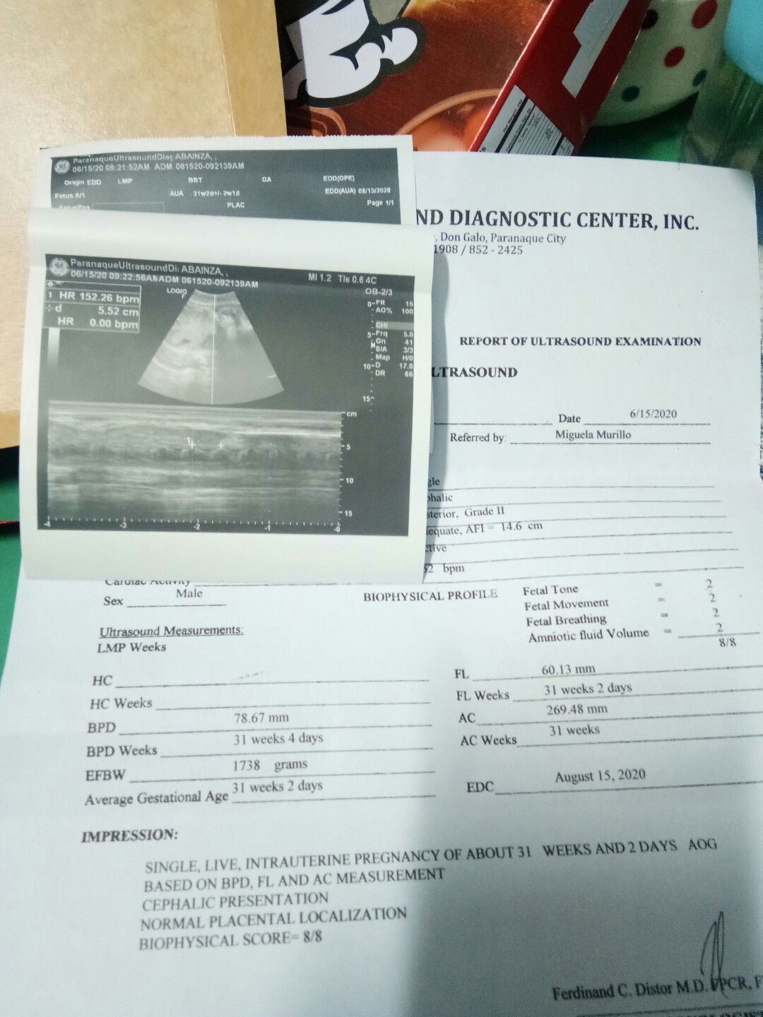 TEAM AUGUST , it's a boy 😊😊