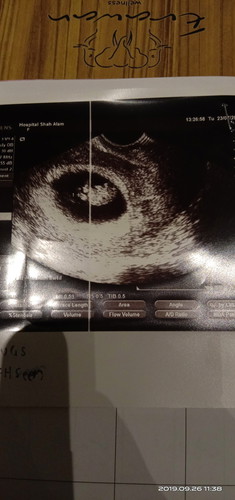 kedudukan placenta