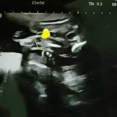 ibu2 yang bolej tengok