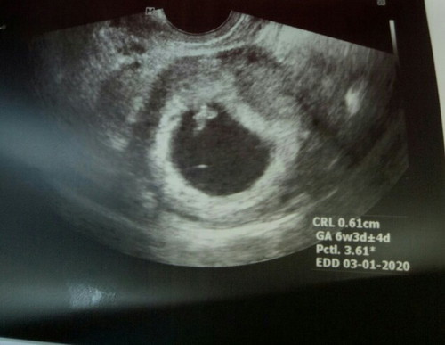 Maganda po ba yung position??