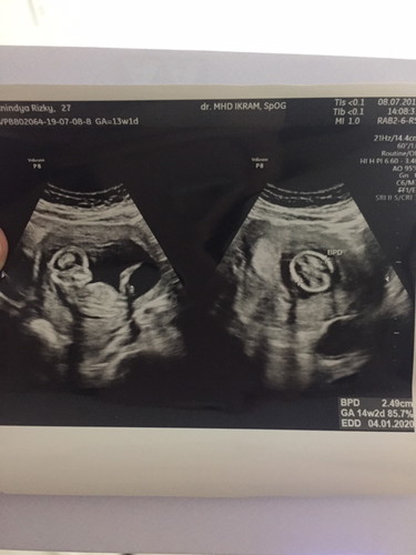 13 week 1 hari