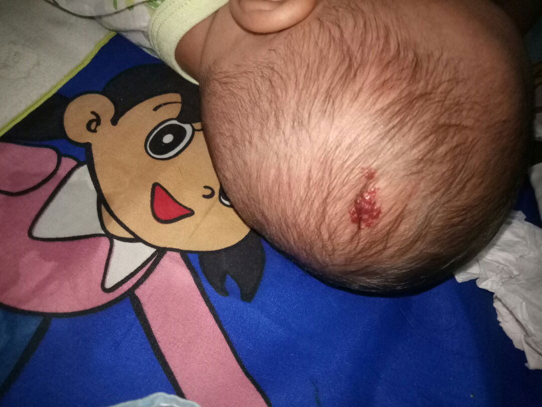 benjolan merah d kepala