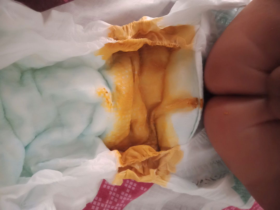 Poops ni baby malambot