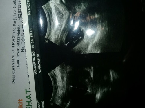 uk 7minggu