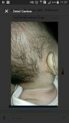 Ruam pada kepala bayi