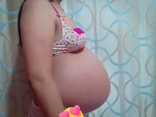 37w4d