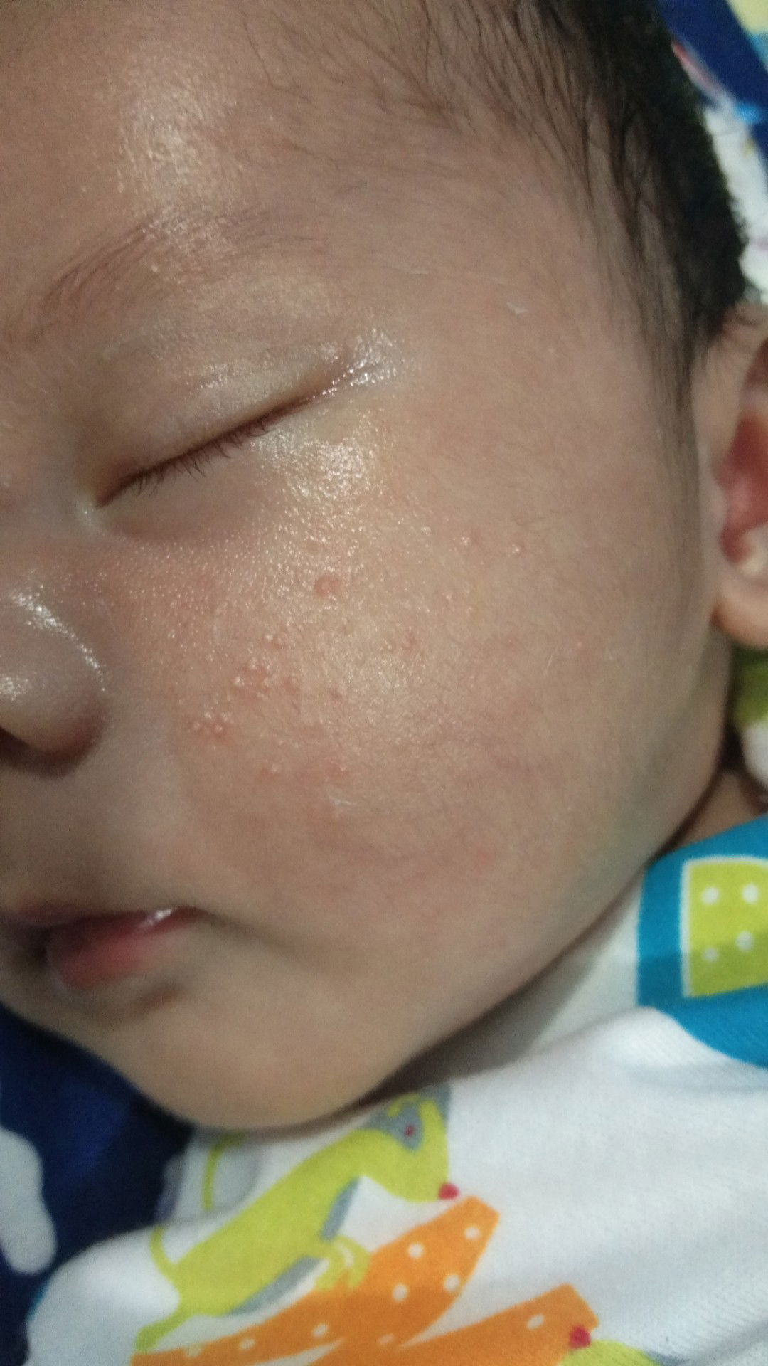 ini kenapa dan obatnya apa?