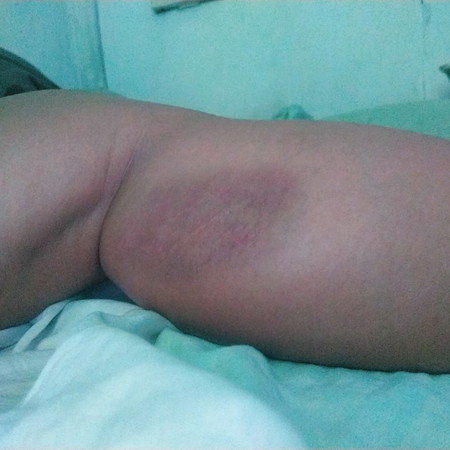 Pangalawang Beses na